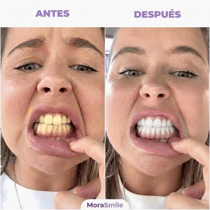 Enjuague Bucal Morado Blanqueador