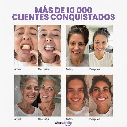 Enjuague Bucal Morado Blanqueador